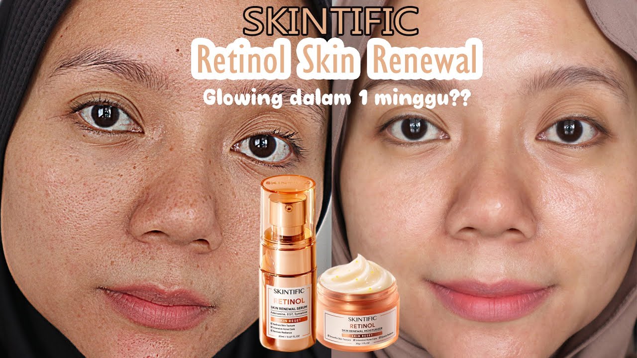 BARU !! SKINTIFIC RETINOL SKIN RENEWAL SERUM & MOISTURIZER ✨ COCOK UNTUK PEMULA ??