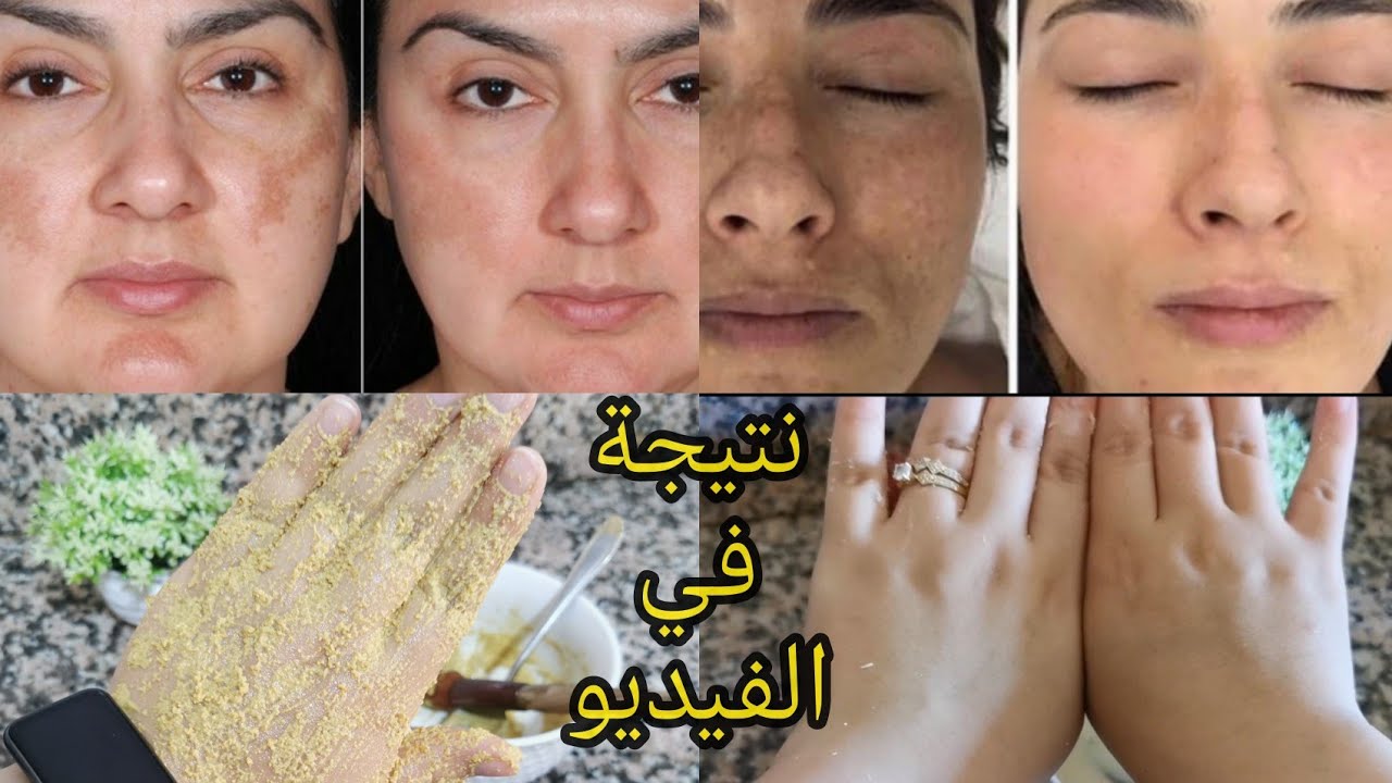 أخطر تبريمة صحراوية لتبييض الوجه لهناتني من التصبغات والشوائب من اول استعمال👌