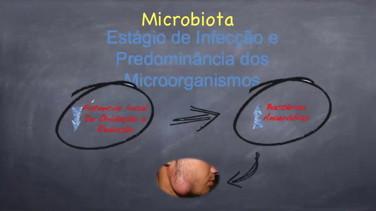 Infecçoes odontogenicas parte 1