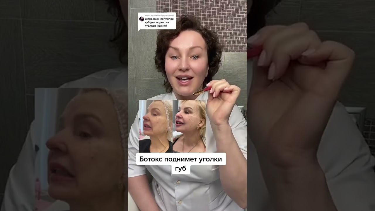 #Ботокс поднимает уголки губ