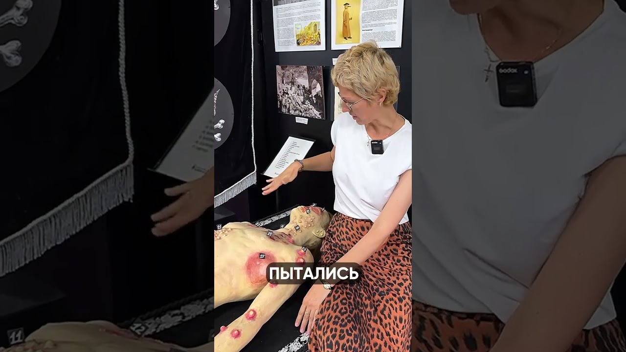 😱 Самый ЖЕСТКИЙ способ лечения #лечение #болезни #музей #способ #история