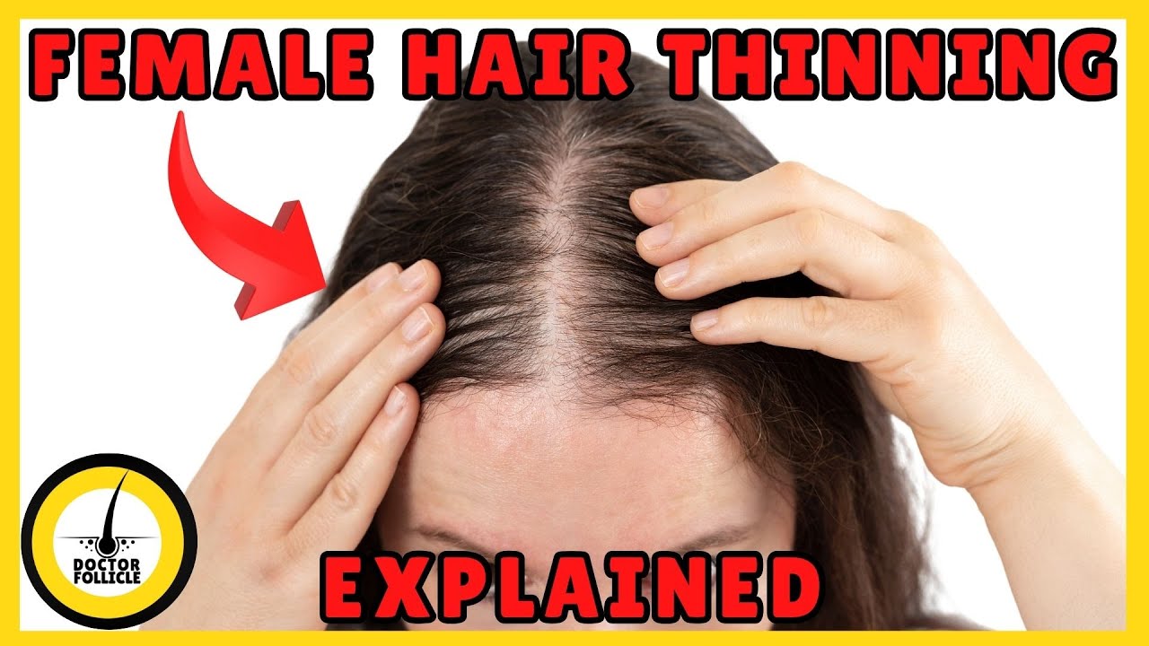 Female Hair Thinning: Hormonal Causes & Evidence-Based Treatments