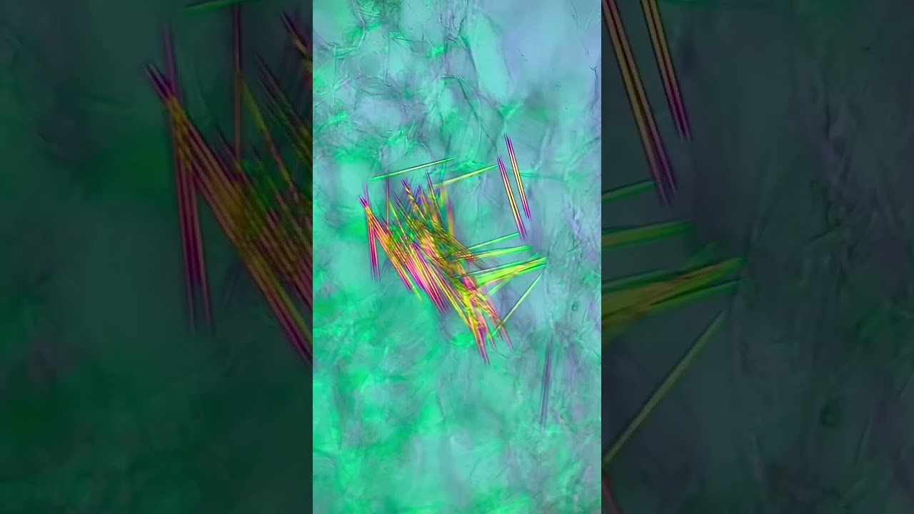 This is why pineapple makes your mouth itchy 🪡 #science #microscope #food #shorts #art