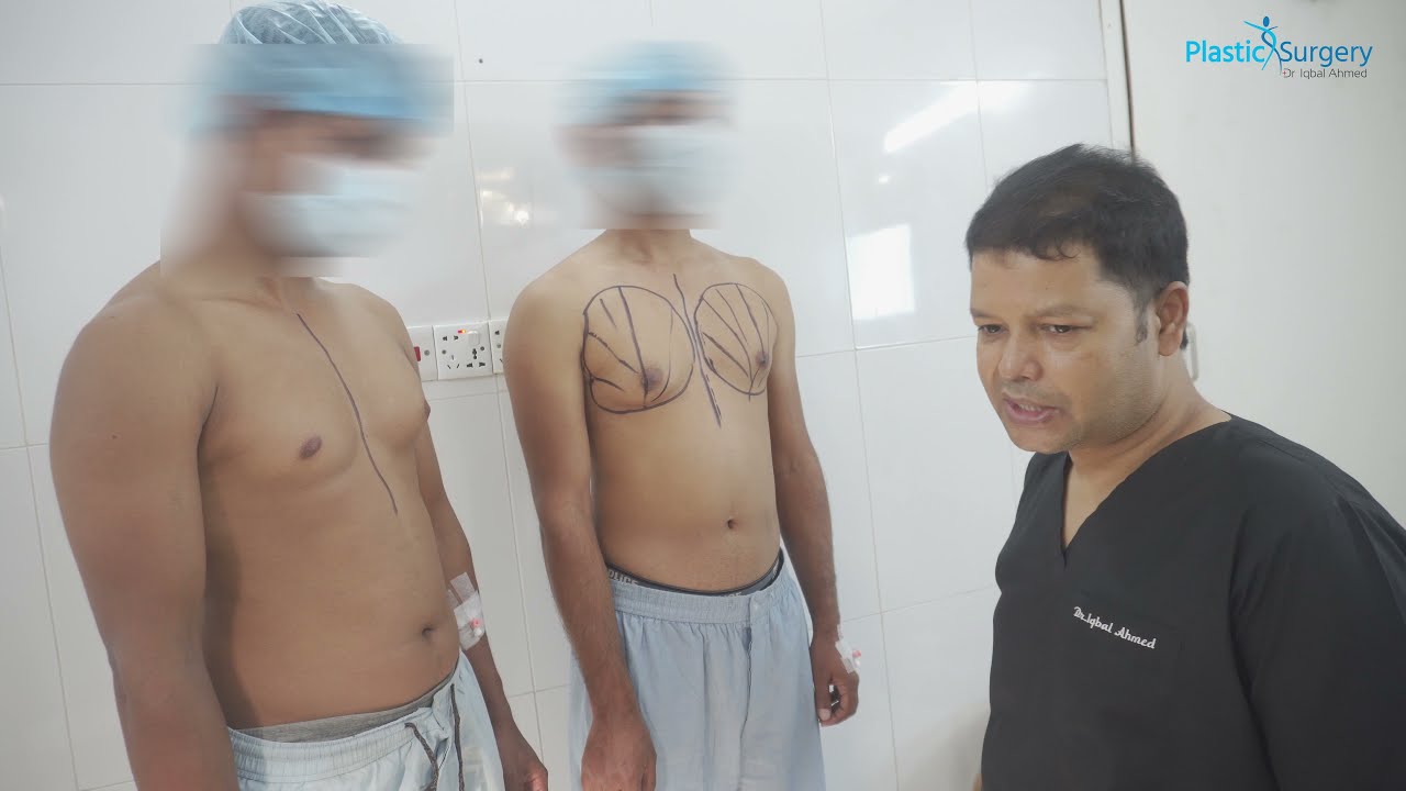 Chest fat removal | male breast reduction | Gynecomastia surgery Bangladesh | Dr Iqbal Ahmed