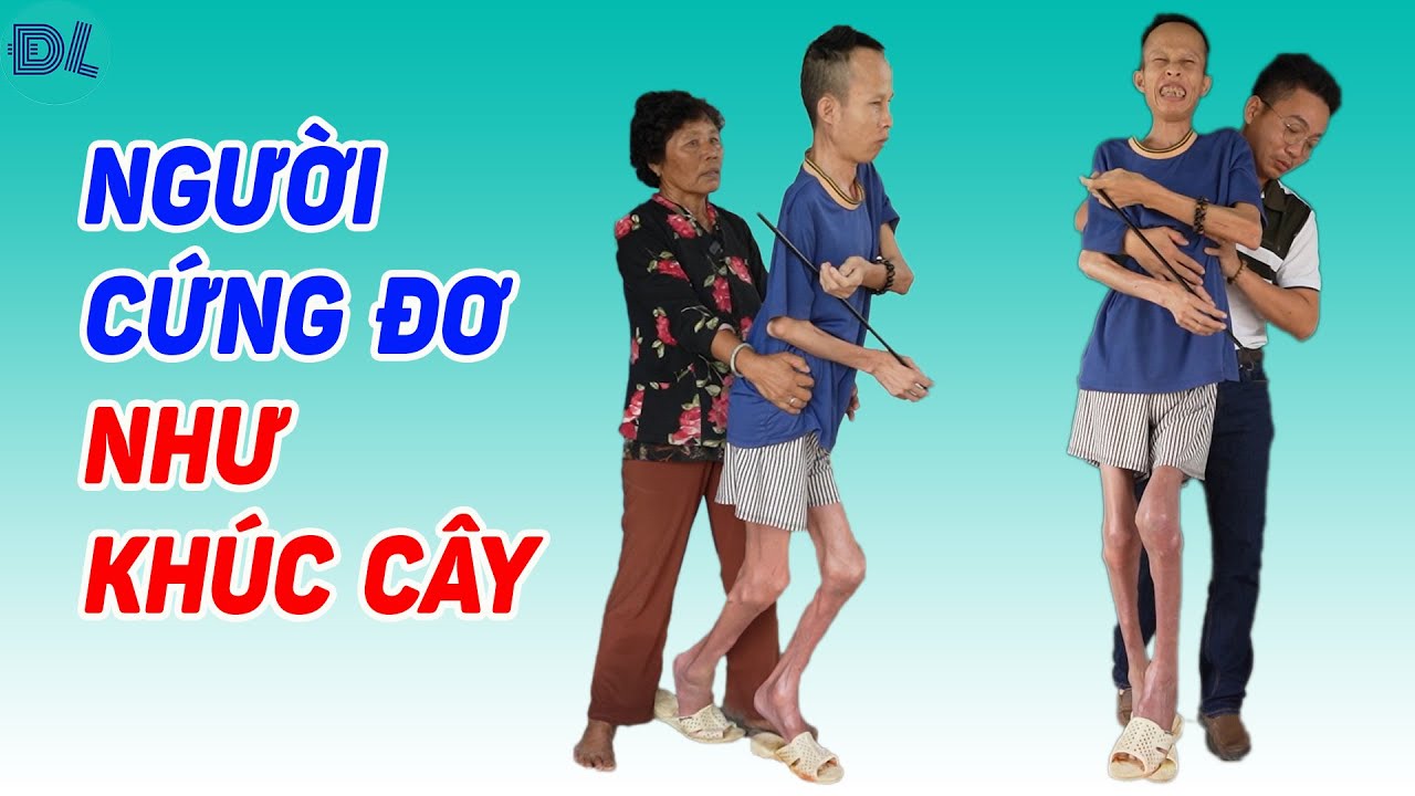 Sự thật chuyện người đàn ông cứng như khúc cây, giống người bị điểm huyệt - ĐỘC LẠ BÌNH DƯƠNG