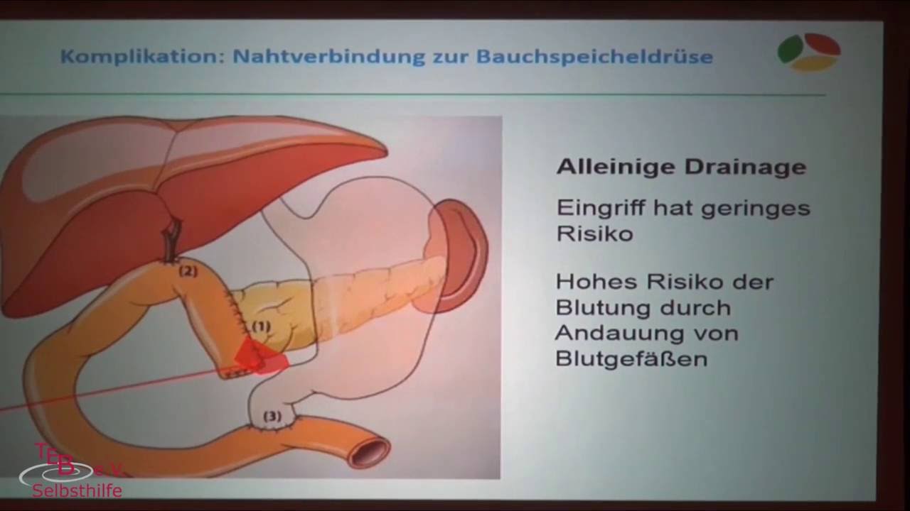 10. Ärzte- und Patientenseminar: Tumore und Erkrankungen der Bauchspeicheldrüse