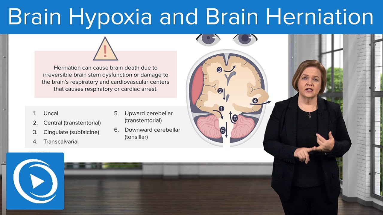 Brain Hypoxia and Brain Herniation – Med-Surg Nursing | Lecturio