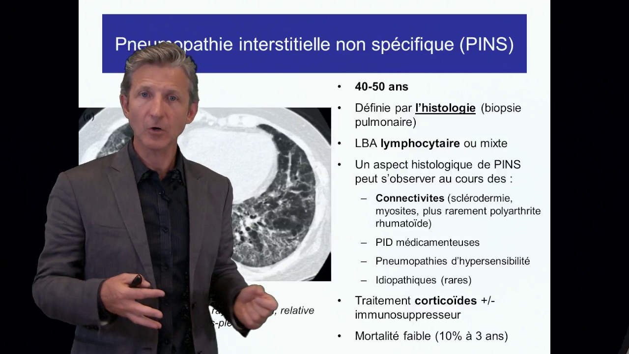 ECN PID cours 3 Autres PID pneumopathies interstitielles diffuses DFASM1 Pr V. Cottin