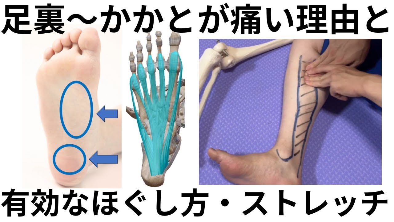 【足裏～かかとの痛み解消に】足底筋膜炎に有効なほぐし方とストレッチ