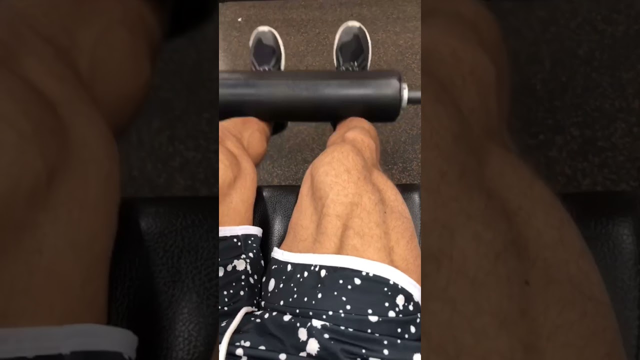 Quadricep Muscle Striations