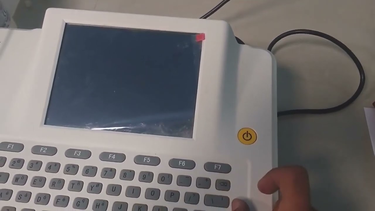 EPG 12 view software update #electrocardiography