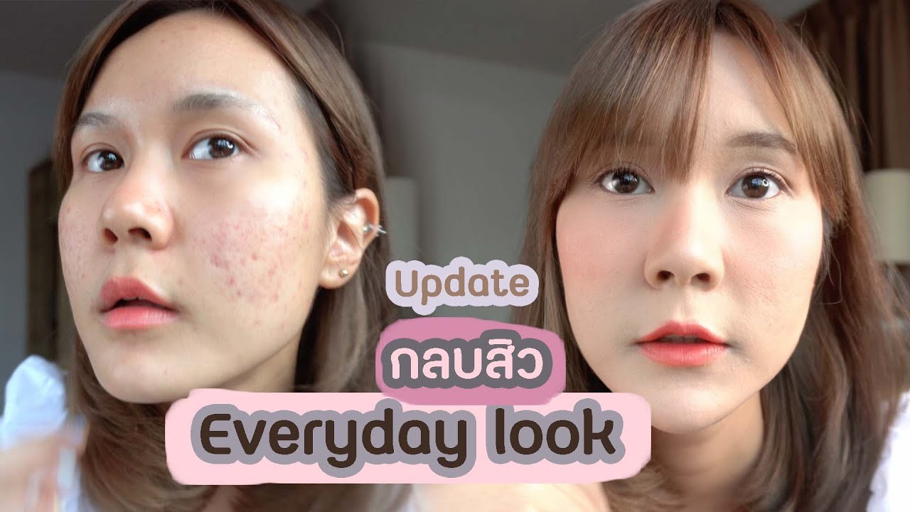 How to แต่งหน้ากลบสิว Everyday look แบบรักษาสิวไปพร้อม ๆกัน เนียนกริบ l This is Pear