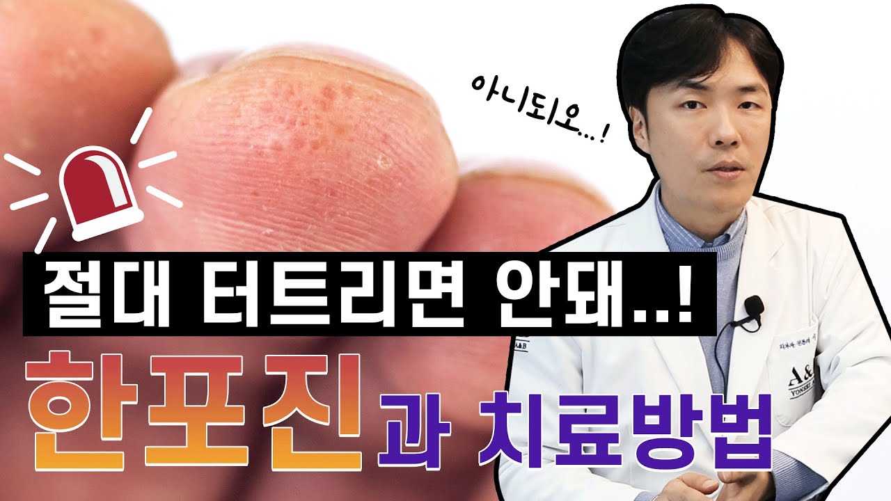 그냥 물집인 줄 알았는데, 이게 한포진 이라구요?  | 한포진 치료 방법 | 연세에이엔비 피부과 이해진 원장