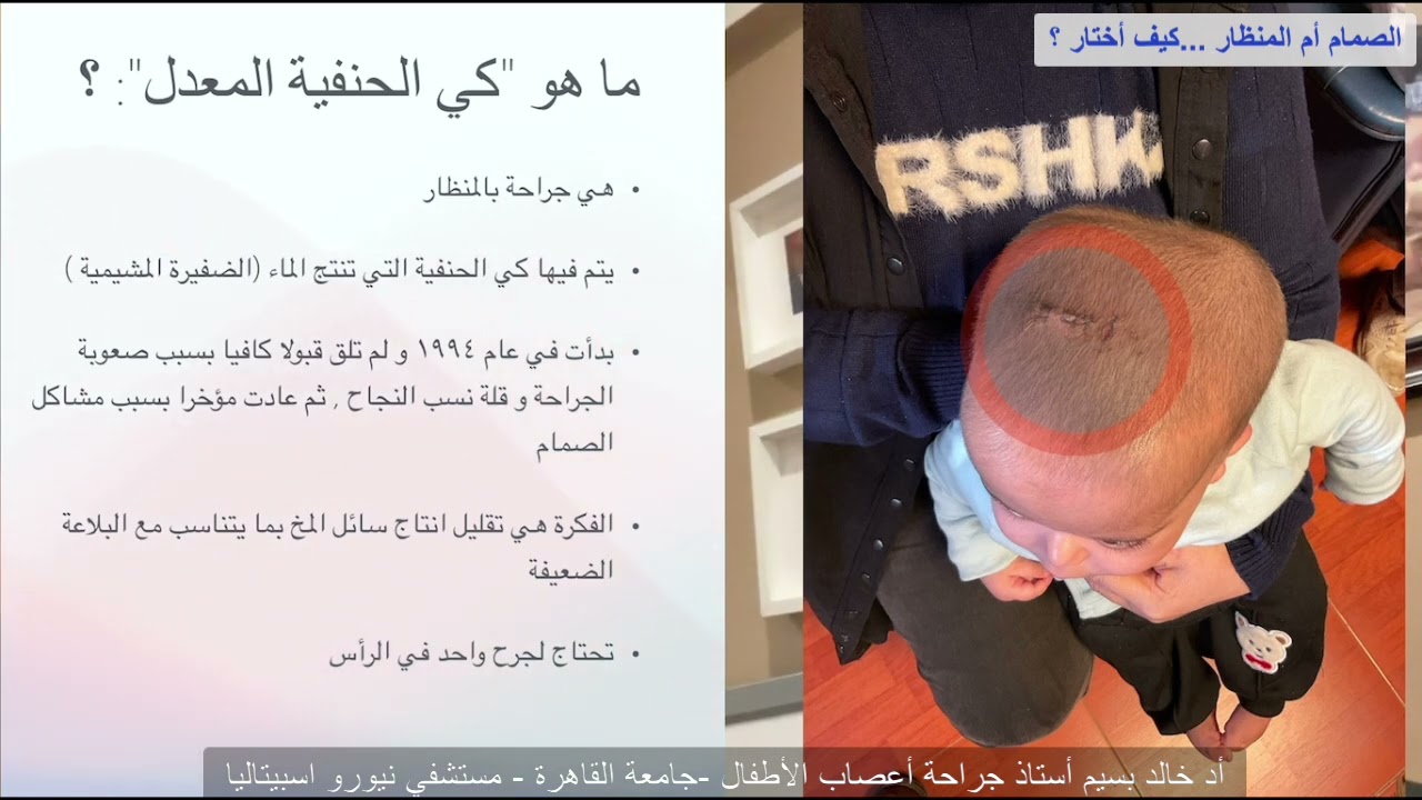 الصمام ام جراحة كي الحنفية (بعد التعديلات ) ...كيف أختار بينهما ؟