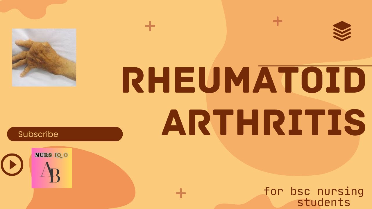 RHEUMATOID ARTHRITIS