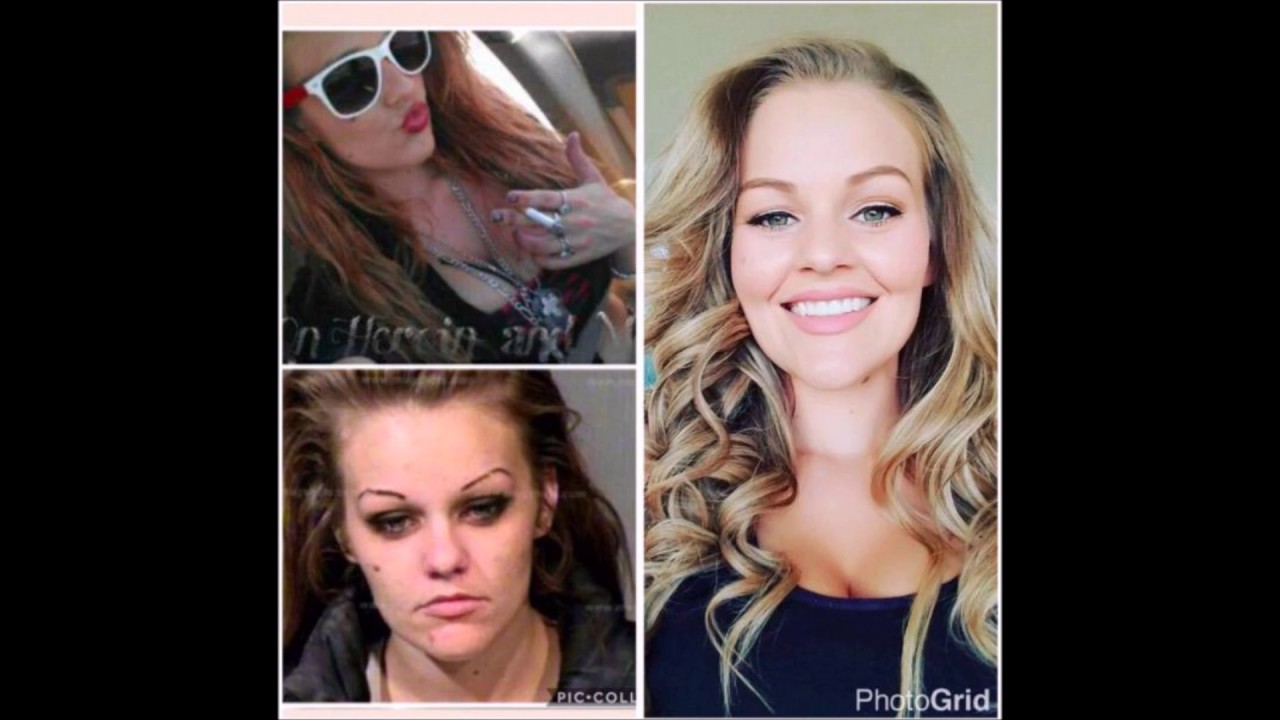 Mother Shares Before and After Photos of Meth Addiction, Inspires Many