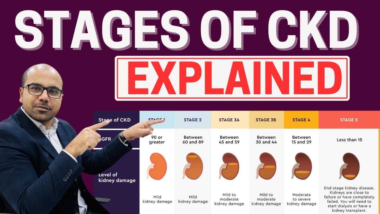 Do You Know This About CKD STAGES? | AwaisZaka.com | Episode 141
