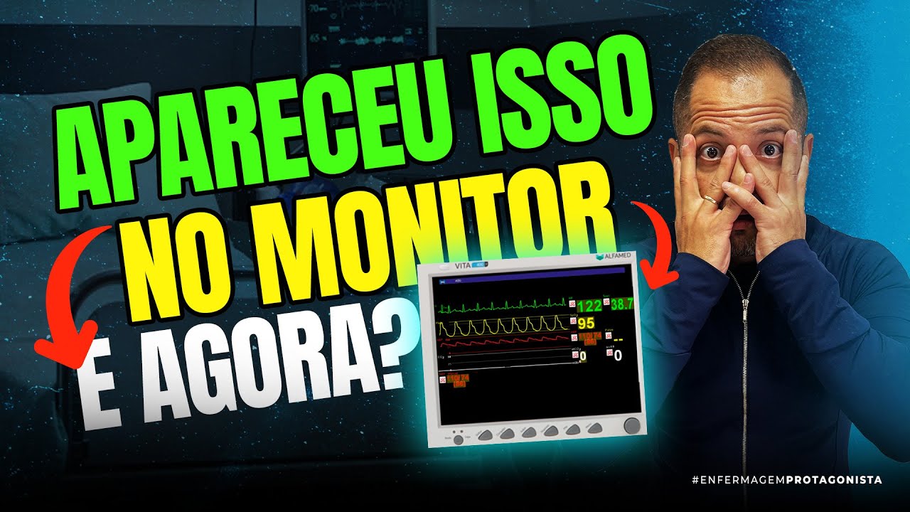 Taquicardia Sinusal | O que fazer?