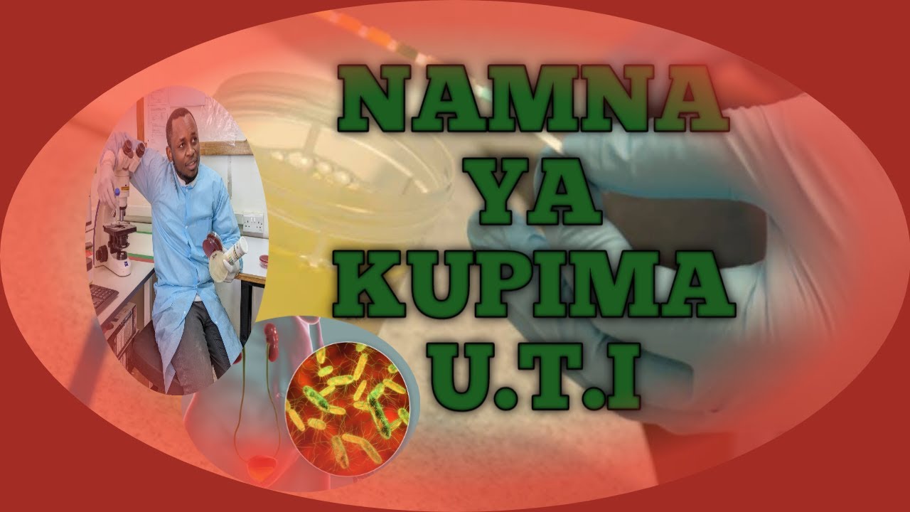 NAMNA YA KUPIMA U T I DIAGNOSIS OF U T I SWAHILI VERSION SBK
