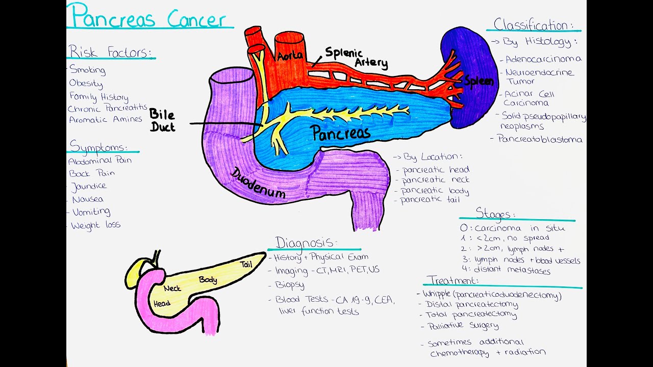 Understanding Pancreas Cancer - Risk factors, Symptoms, Diagnosis, Treatment, Classification