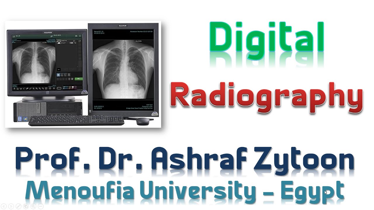 Dark Room (6) ... Digital Radiography الغرفة المظلمة للأشعة التشخيصية (الأشعة الرقمية)