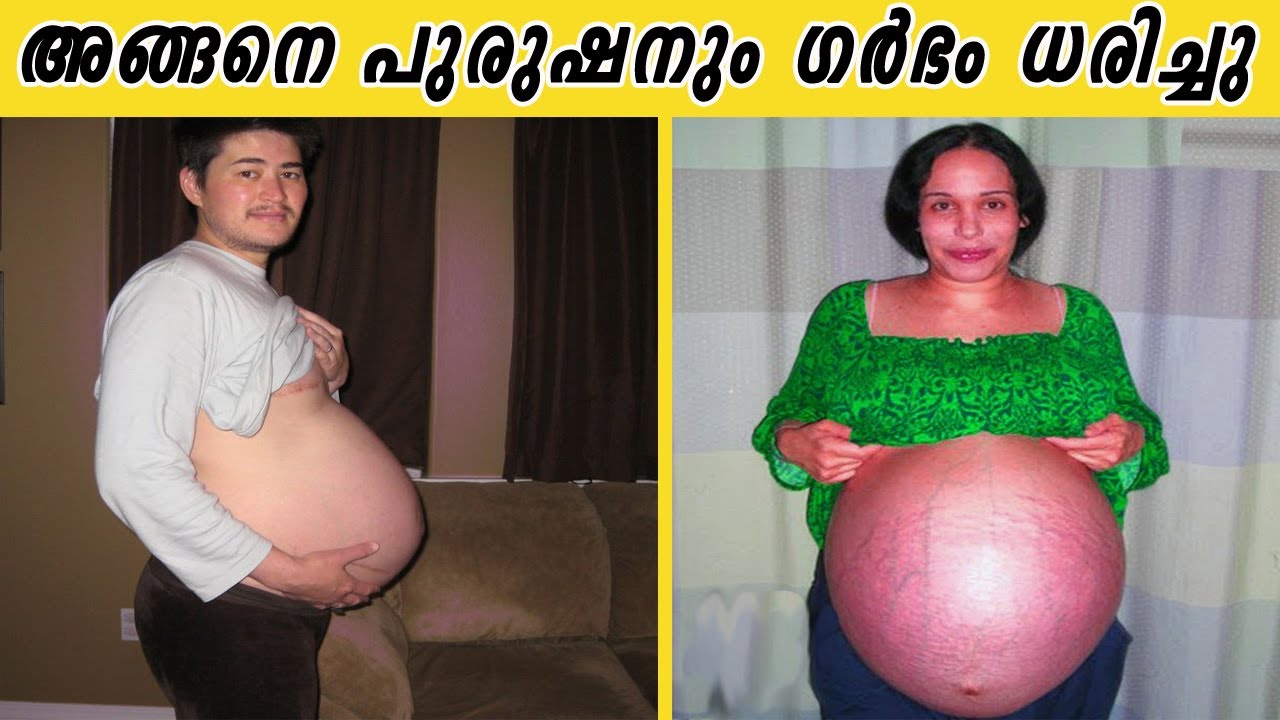 ഇങ്ങനെയും ഗർഭിണികളോ! ലോകത്തെ വിസ്മയിപ്പിച്ച അത്യപൂർവ ഗർഭാവസ്ഥകൾ