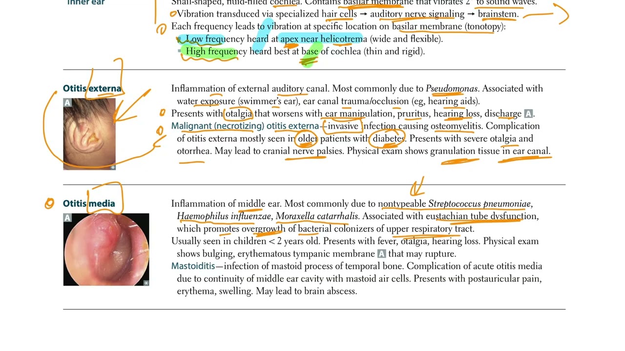 USMLE - ENT - Otology  (USMLE Step 1)