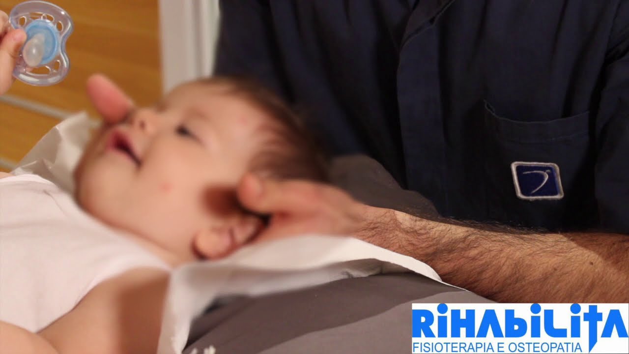 PLAGIOCEFALIA IL TRATTAMENTO OSTEOPATICO