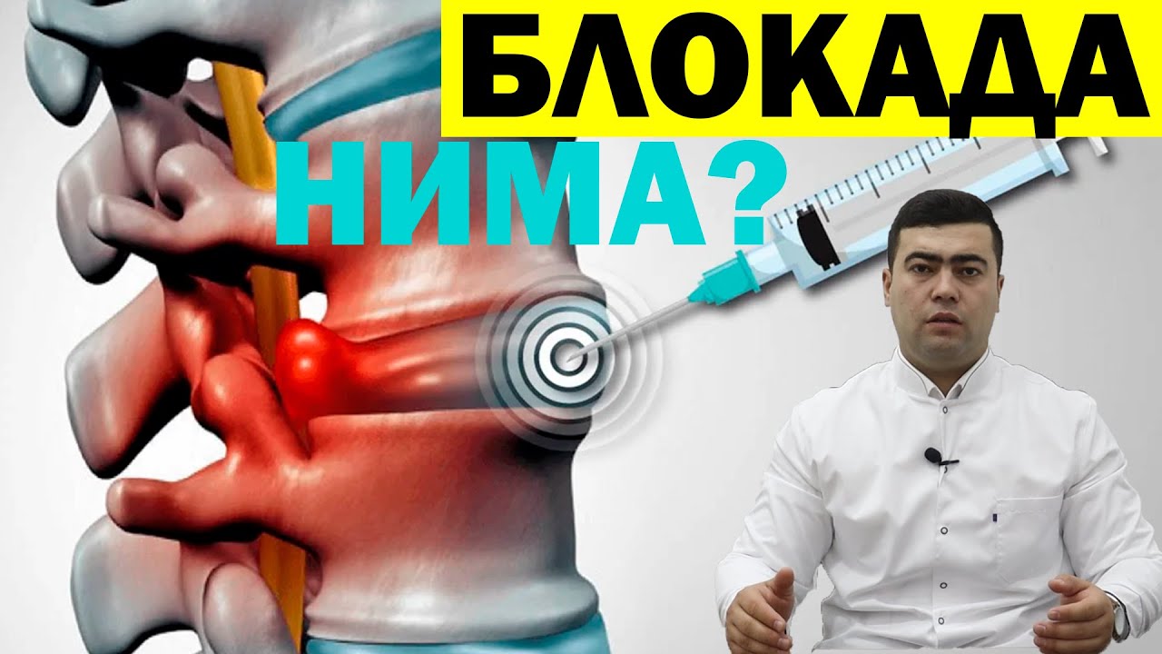 БЛОКАДА ГРЫЖАНИ ДАВОЛАЙДИМИ ? ОГРИК КОЛДИРУВЧИ ПРЕПАРАТЛАР