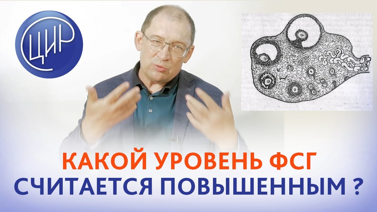 Повышен ФСГ. Какой уровень ФСГ считается повышенным? Отвечает Гузов И.И.