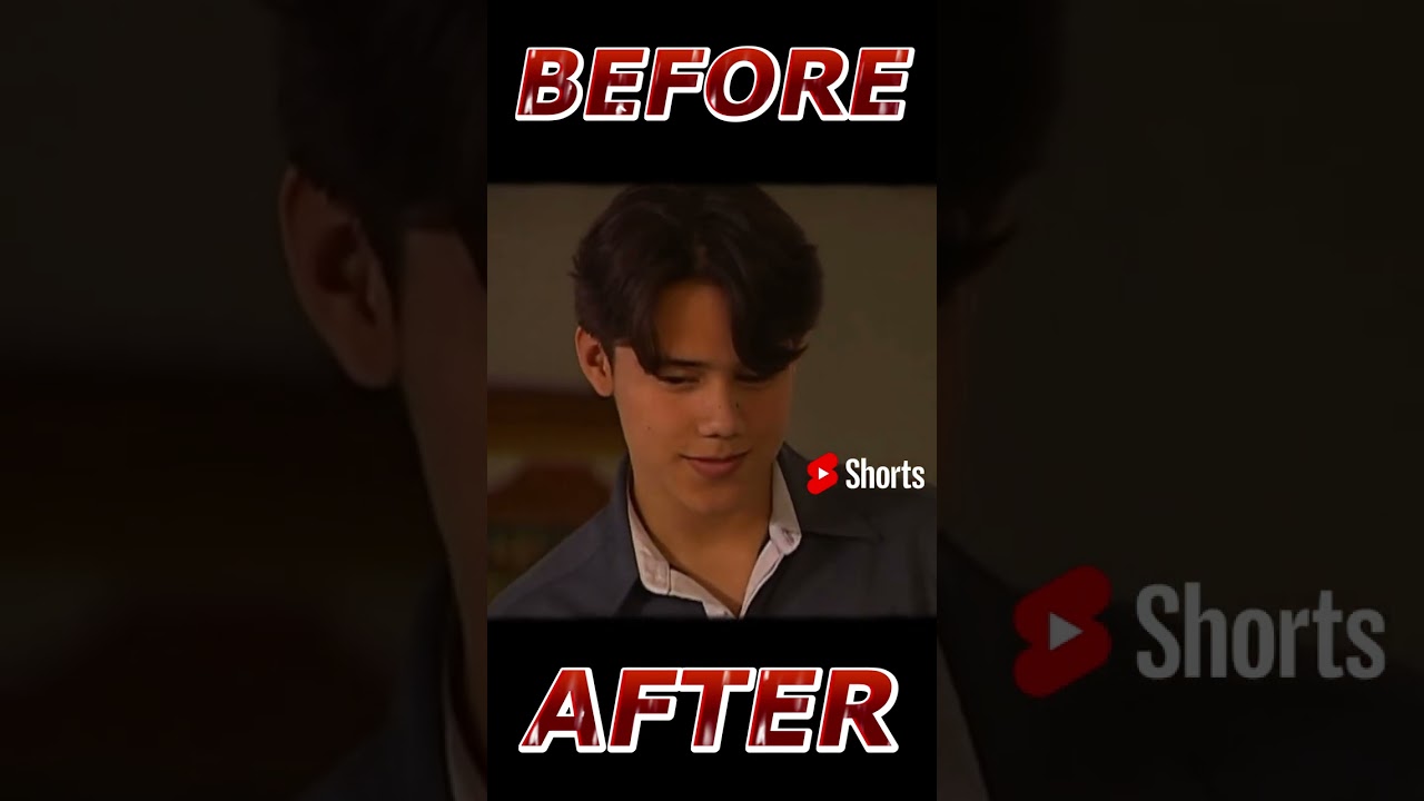 PATRICK GARCIA BEFORE AND AFTER #shorts #beforeandafter #showbiz  #thenandnow