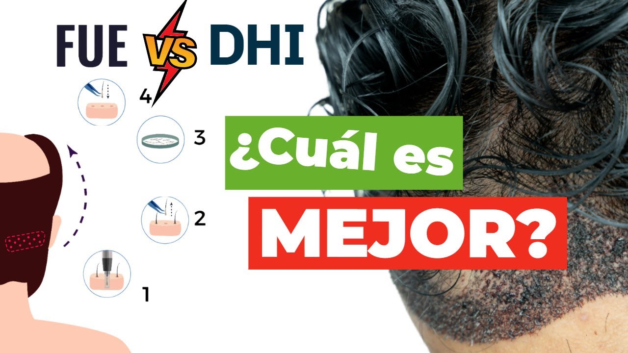 FUE ZAFIRO o DHI // ¿CUÁL ES MEJOR PARA MÍ?