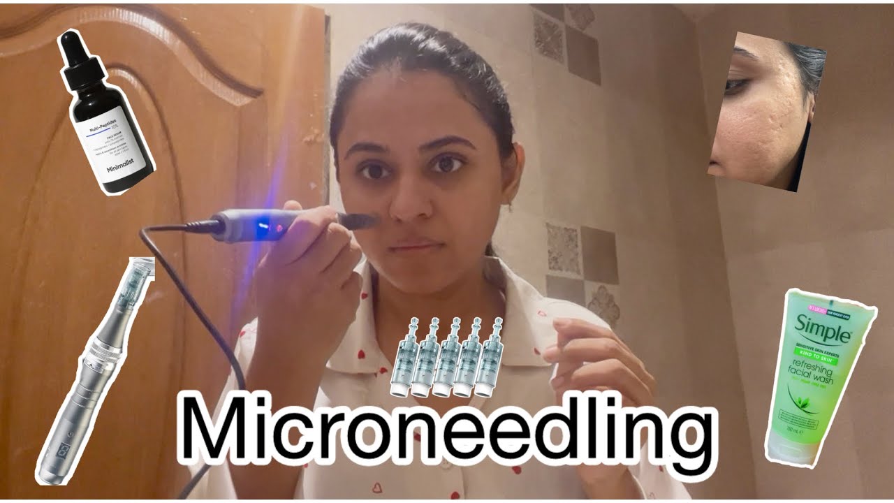 How I microneedle my face using dr pen m8