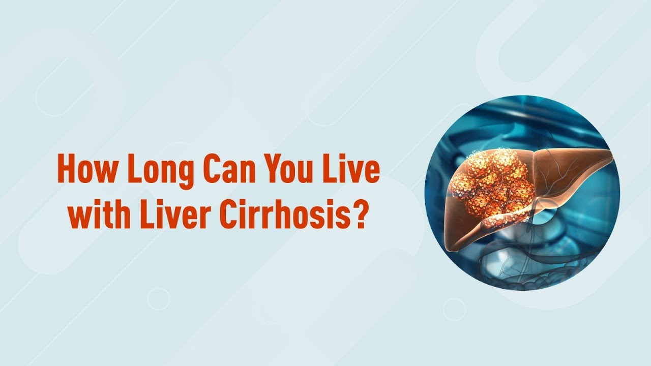How Long Can You Live with Liver Cirrhosis?