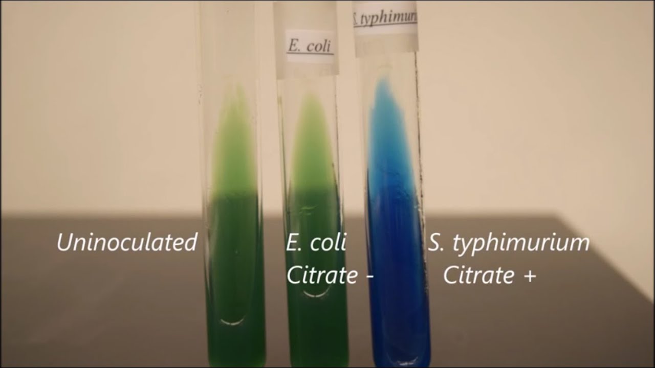 IMViC Time-lapse (Indole, MR-VP and Citrate)
