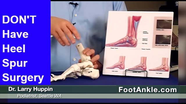 Heel Spur Treatment &ndash; How to Avoid Heel Spur Surgery | Seattle Podiatrist