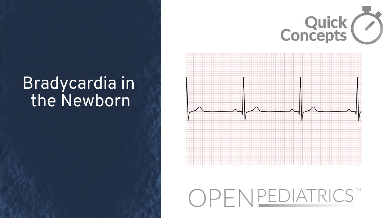 Брадикардия у новорожденных, автор М. Фрид | OPEN Pediatrics