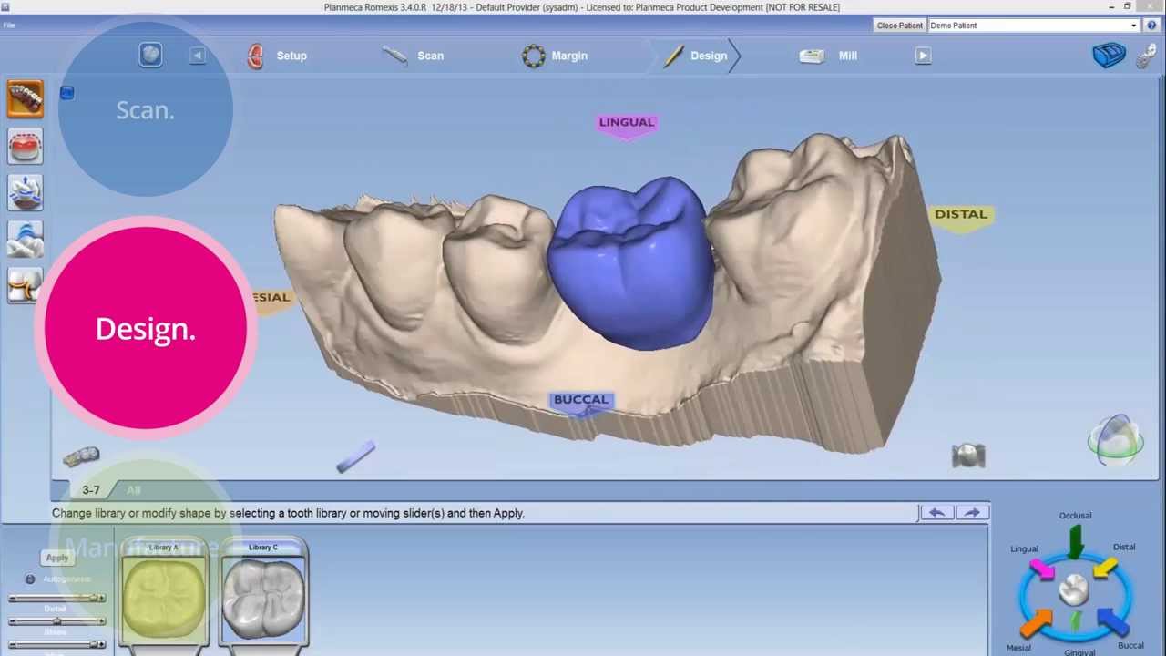 Planmeca CAD/CAM solutions