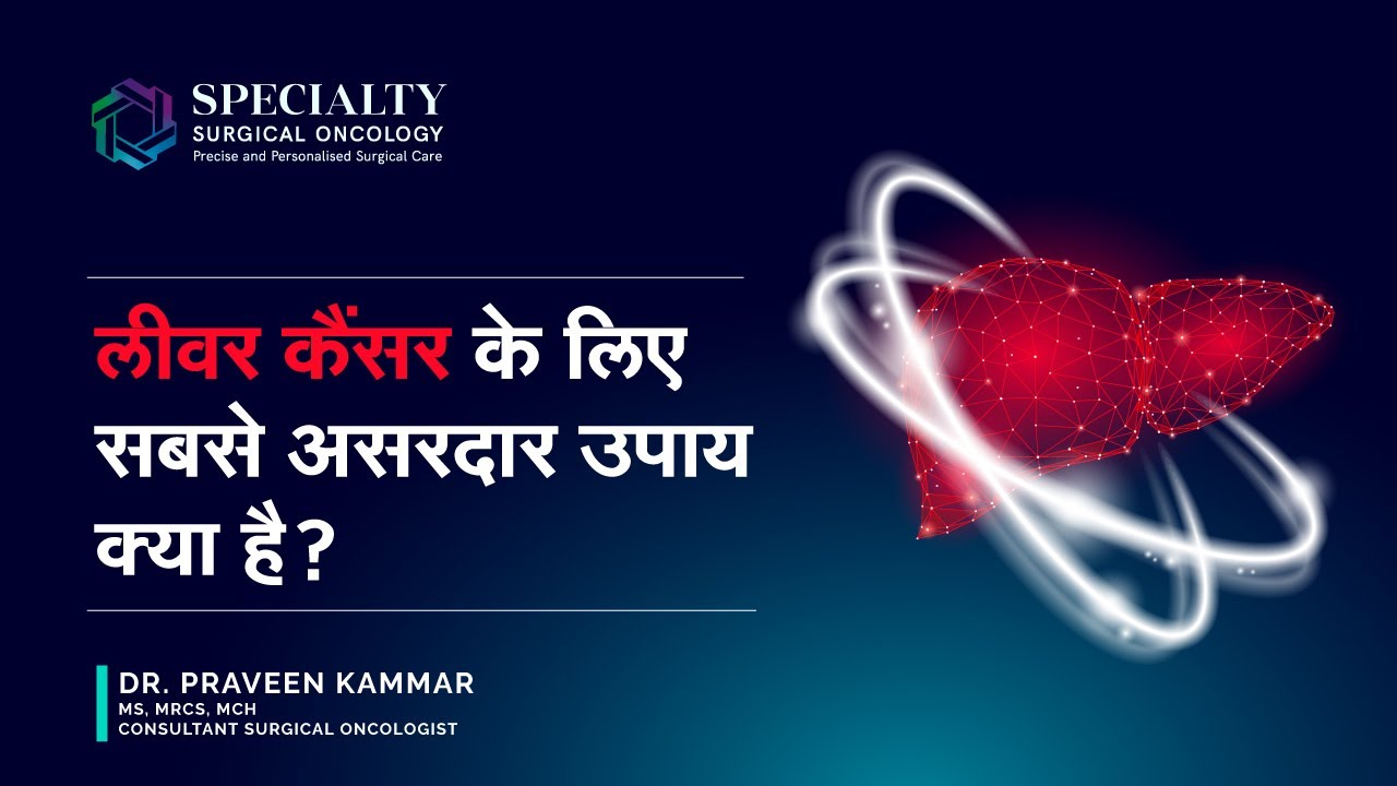 लीवर कैंसर के लिए सबसे असरदार उपाय क्या है? | Treatment for Liver Cancer | Dr Praveen Kammar, SSO