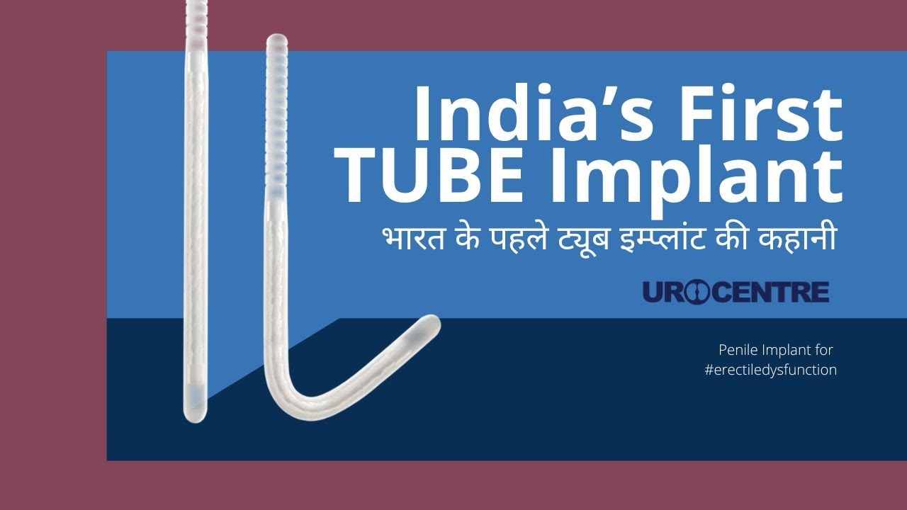 TUBE penile implant kya hai? Interview of India's First TUBE implant done in February 2022: