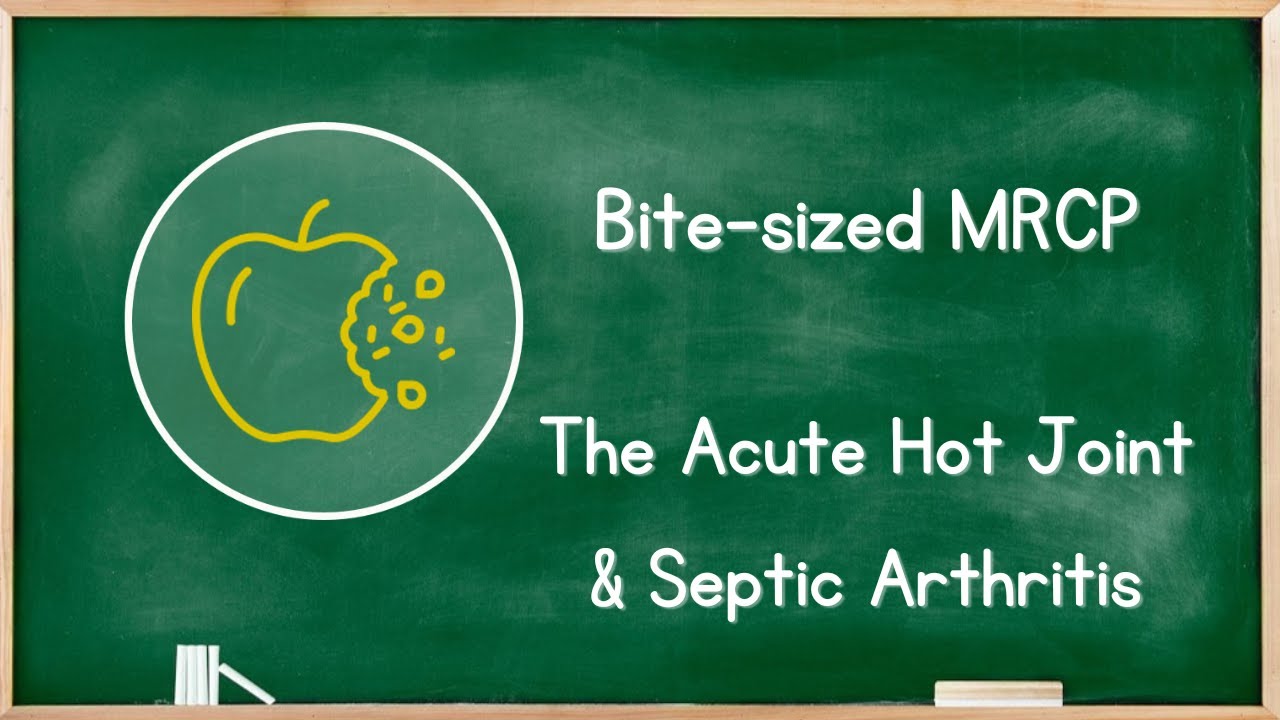 Rheumatology - Acute Hot Joint & Septic Arthritis - MRCP Exam Revision