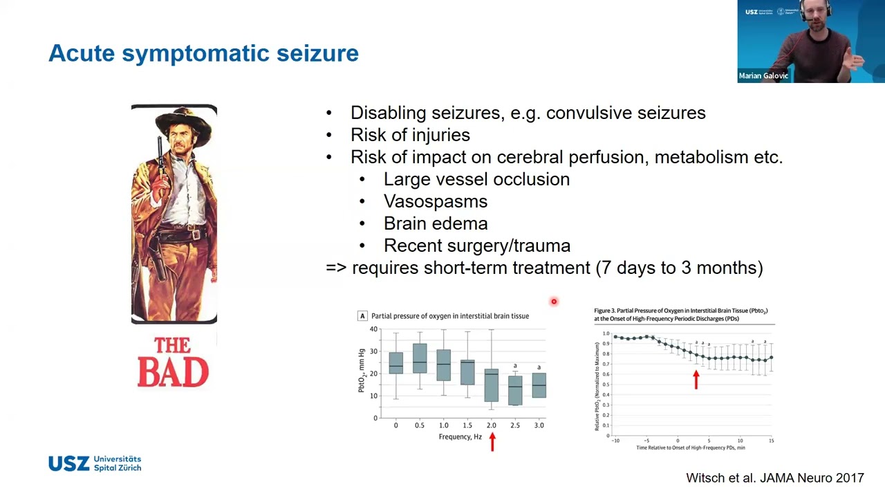 CETN Rounds: Post Stroke Epilepsy by Dr. Marian Galovi