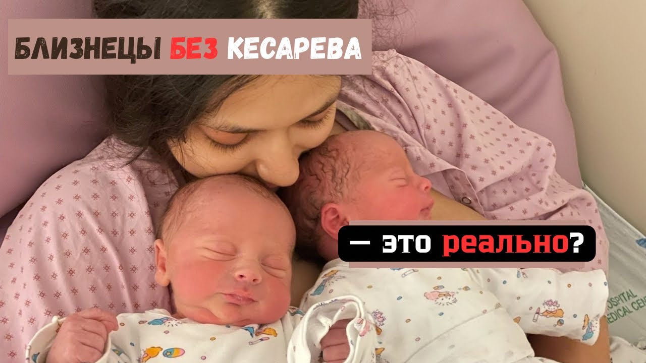 🌸 Роды близнецов в Израиле— мой опыт и правда об эпидуралке 💉👶