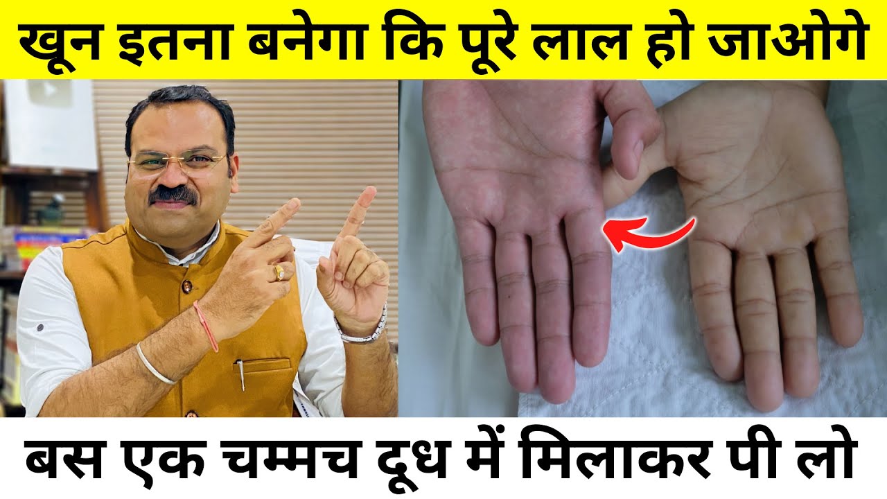 खून की कमी, हर समय थकान और कमज़ोरी को 10 दिन में पूरा करें | khoon ki kami ko kaise dur kare | Anemia