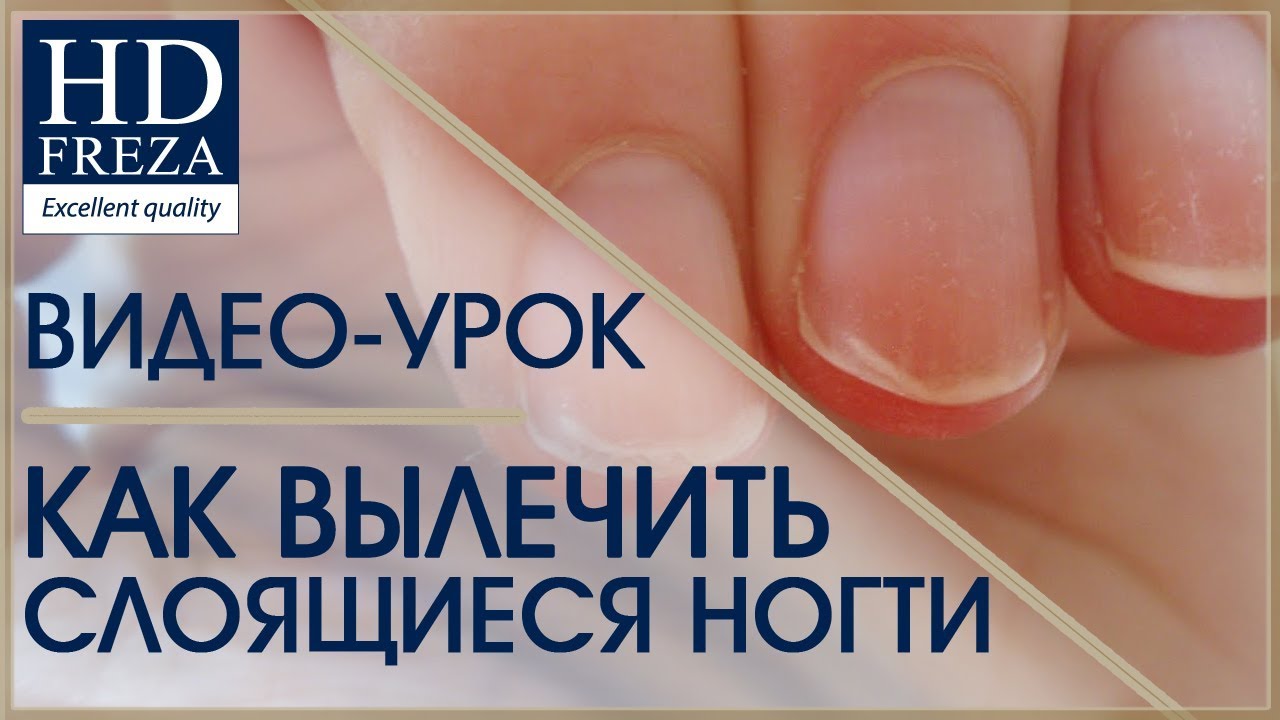 Как вылечить слоящиеся ногти // HD Freza®