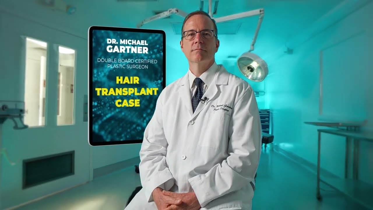 Dr. Gartner Patient Case: 3000 Graft FUE Procedure | Nova Medical Hair Transplant Clinic