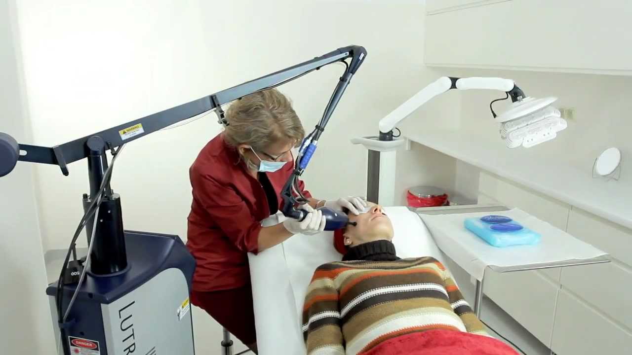 Laser fraksyjny CO2 - Klinika Prof. Dobosz - Gdańsk