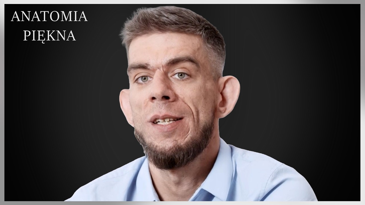 Odstające USZY od zawsze były jego problem. Pozbędzie się niechcianej „wizytówki”? | Anatomia piękna