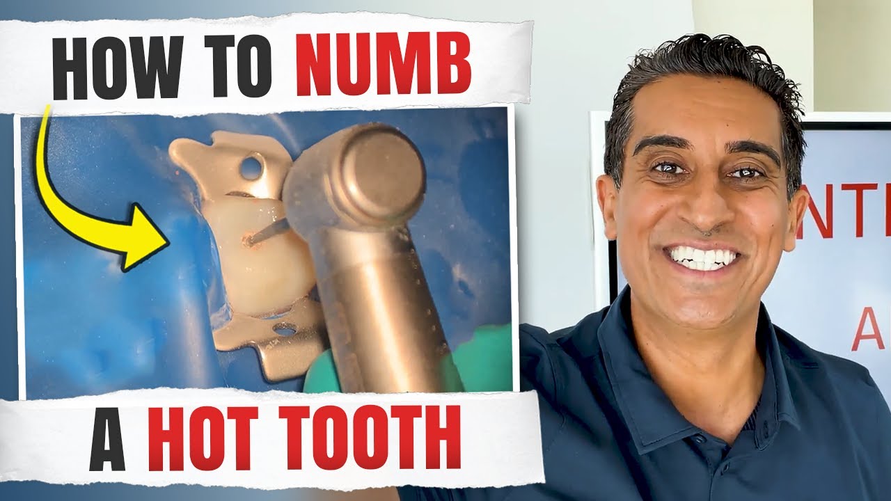 How to Numb A Hot Tooth (Endo Cases)