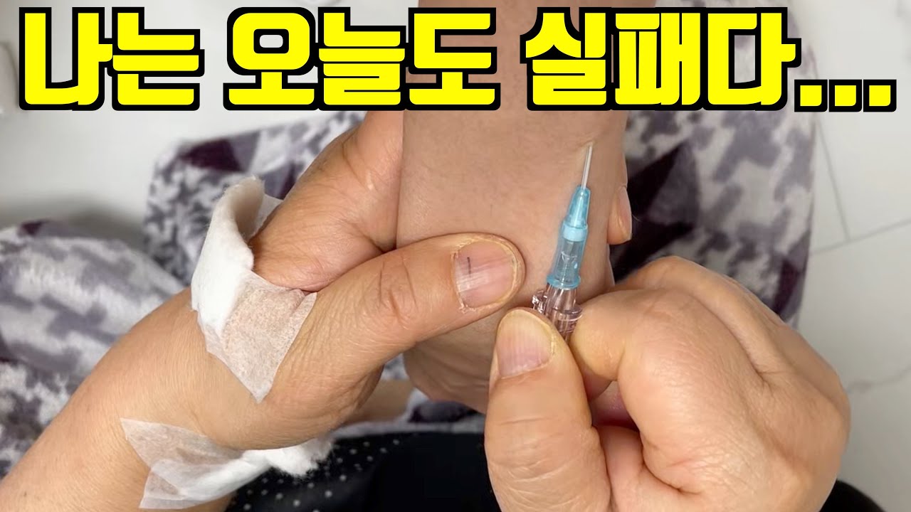 대체왜? 뭐가 문제지? iv실패 오답노트 함께 풀이해보기!! 원인분석 사례1